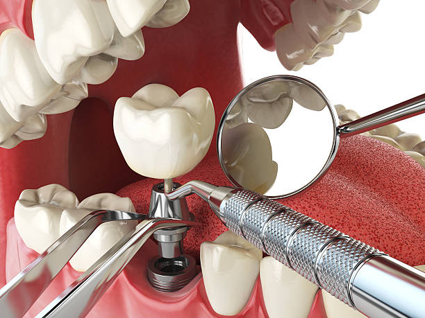 Best Emergency Treatment for Jaw Pain or Injury in Grayson, CA